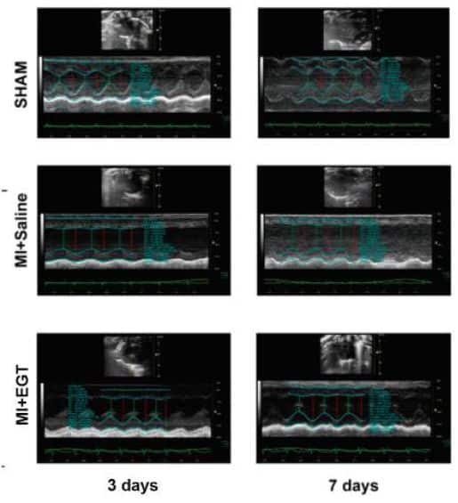 Duan R, Pan H, Li D, et al.
Ergothioneine improves myocardial
remodeling and heart function after
acute myocardial infarction via Sglutathionylation
through the NF-kB
dependent Wnt5a-sFlt-1 pathway [J]. Eur
J Pharmacol, 2023, 950: 175759.