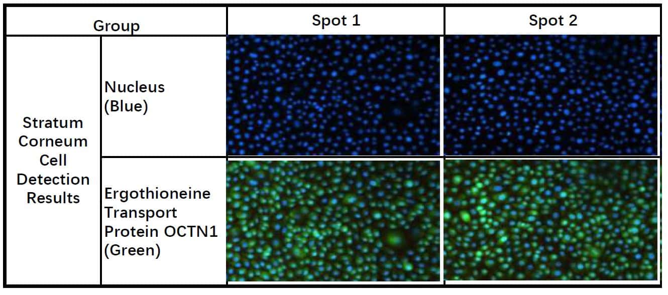 Expression of ergothioneine transporter OCTN1 on stratum corneum cells (green)